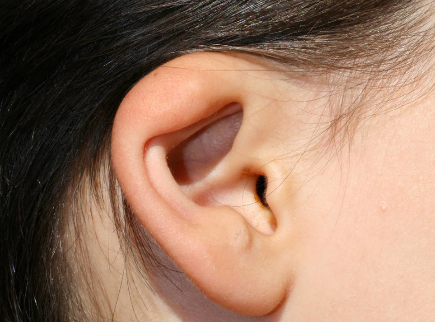 小耳畸形-重建的耳朵怕不怕压?