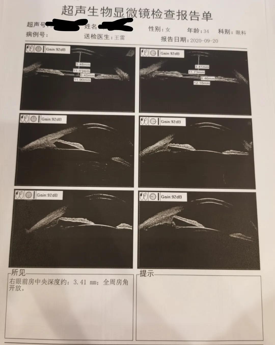 ubm检查结果示例