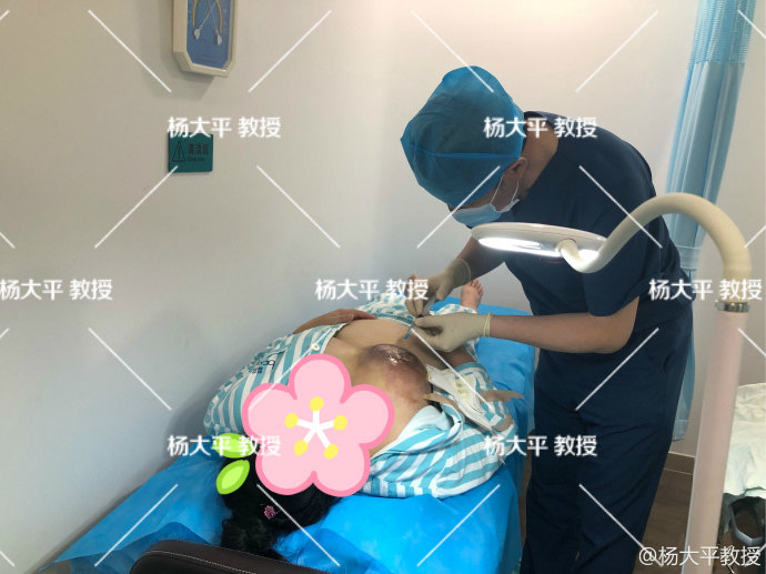 杨大平教授胸部注射奥美定后会导致乳腺癌吗