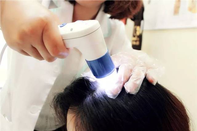 怎么判断毛囊坏死程度?