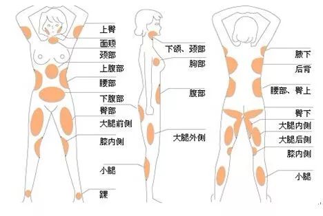 吸脂主要针对的是局部脂肪堆积,对于体重相对正常单局部脂肪推挤明显
