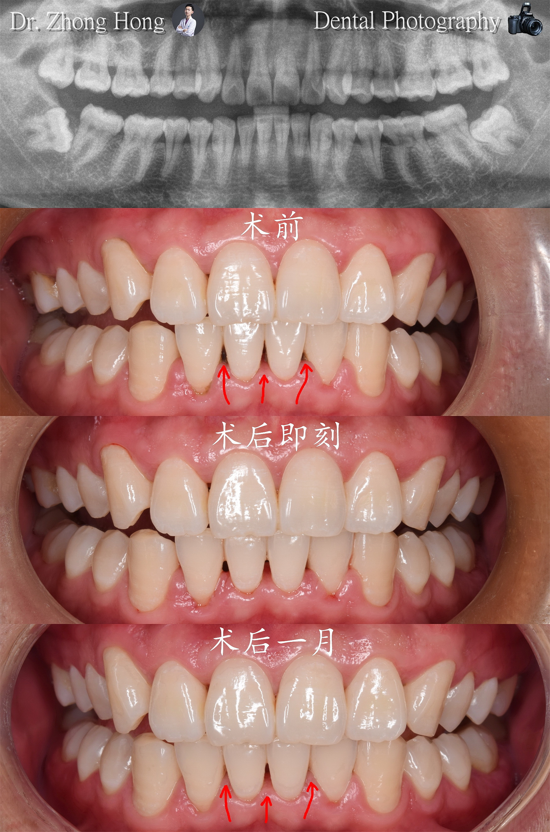 牙科学生学习教学模式展示牙齿、牙根、牙龈、牙龈疾病、蛀牙和牙菌斑。照片摄影图片_ID:309833641-Veer图库