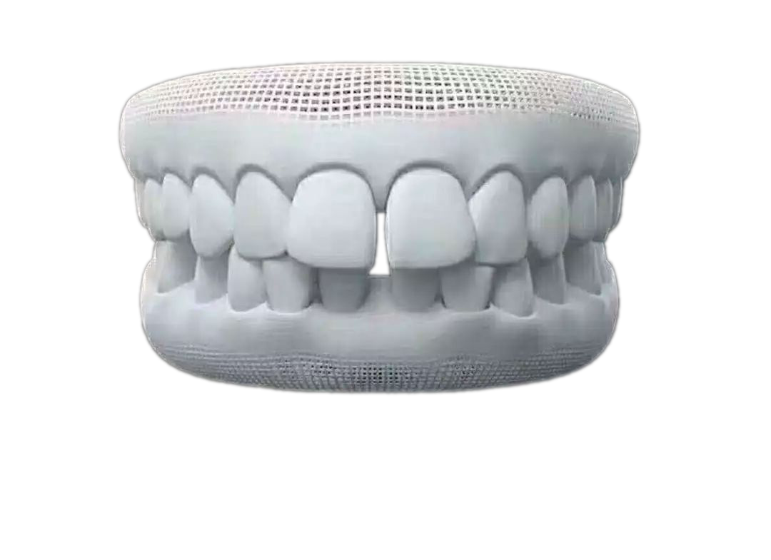 人生必须要做的事——牙齿矫正