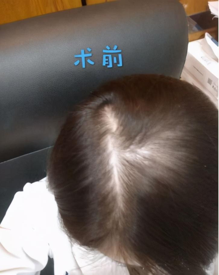 发缝稀疏,正常发缝,发缝正常图片_大山谷图库
