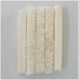 关于异体骨隆鼻,你想知道的都在这里