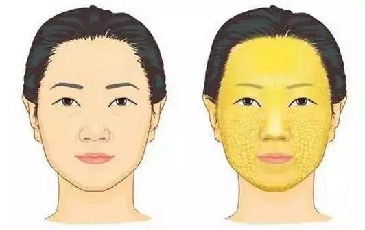 填充面部一般可以维持多久_填充面部_填充面部整形要多少钱