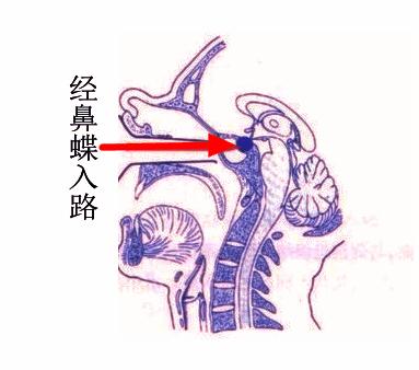 发现颅咽管瘤一定要手术吗要开颅吗可以做微创手术吗