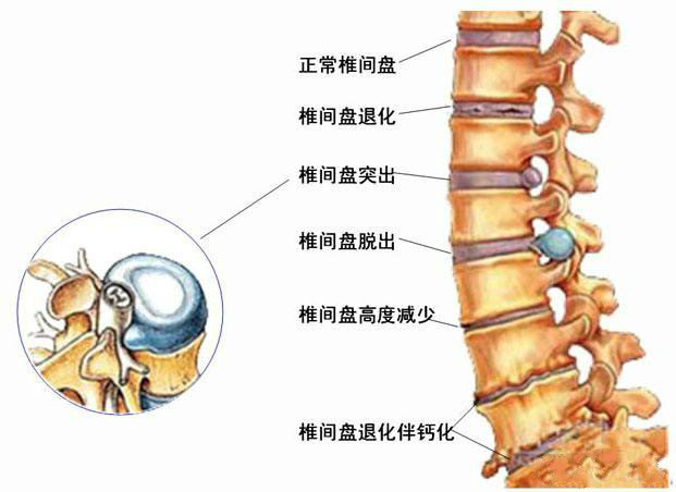 上面的图片显示