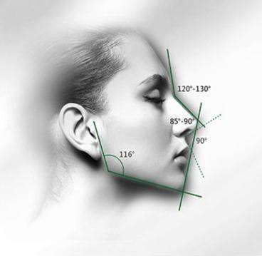 很高,眉间点到鼻根点的线与鼻根点到鼻尖连线之间定义的鼻额角~角度