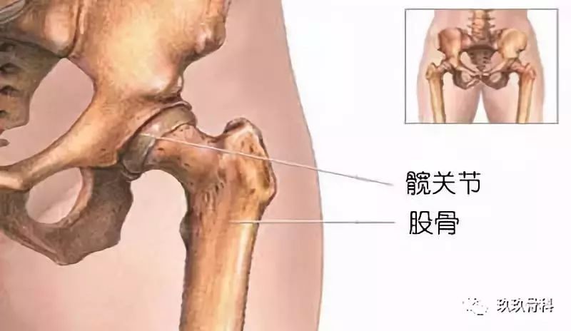 躯干处的髋臼像个倒扣的碗架在股骨