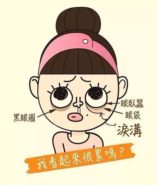 眼袋是下眼睑松弛,即使在静态表情下也会膨出的脂肪组织;泪沟是下眼睑