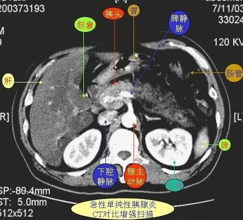 小肠肿瘤如何检查才能发现