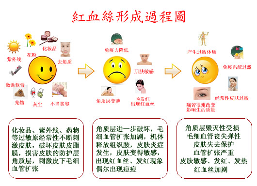 许多人脸部皮肤角质层比较薄,毛细血管分布较浅,所以,对外界刺激特别