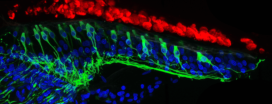 耳蜗毛细胞再生新发现_张华_主任医师_爱问健康