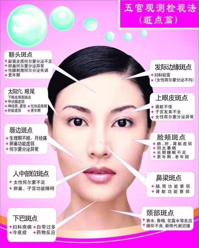 脸上为什么会产生斑 看看这篇文章就都知道了 李万水主治医师 爱问医生