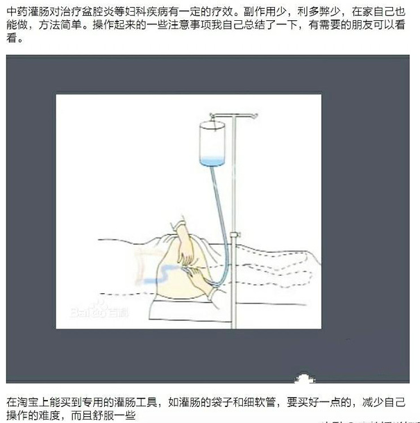 中药灌肠法图片