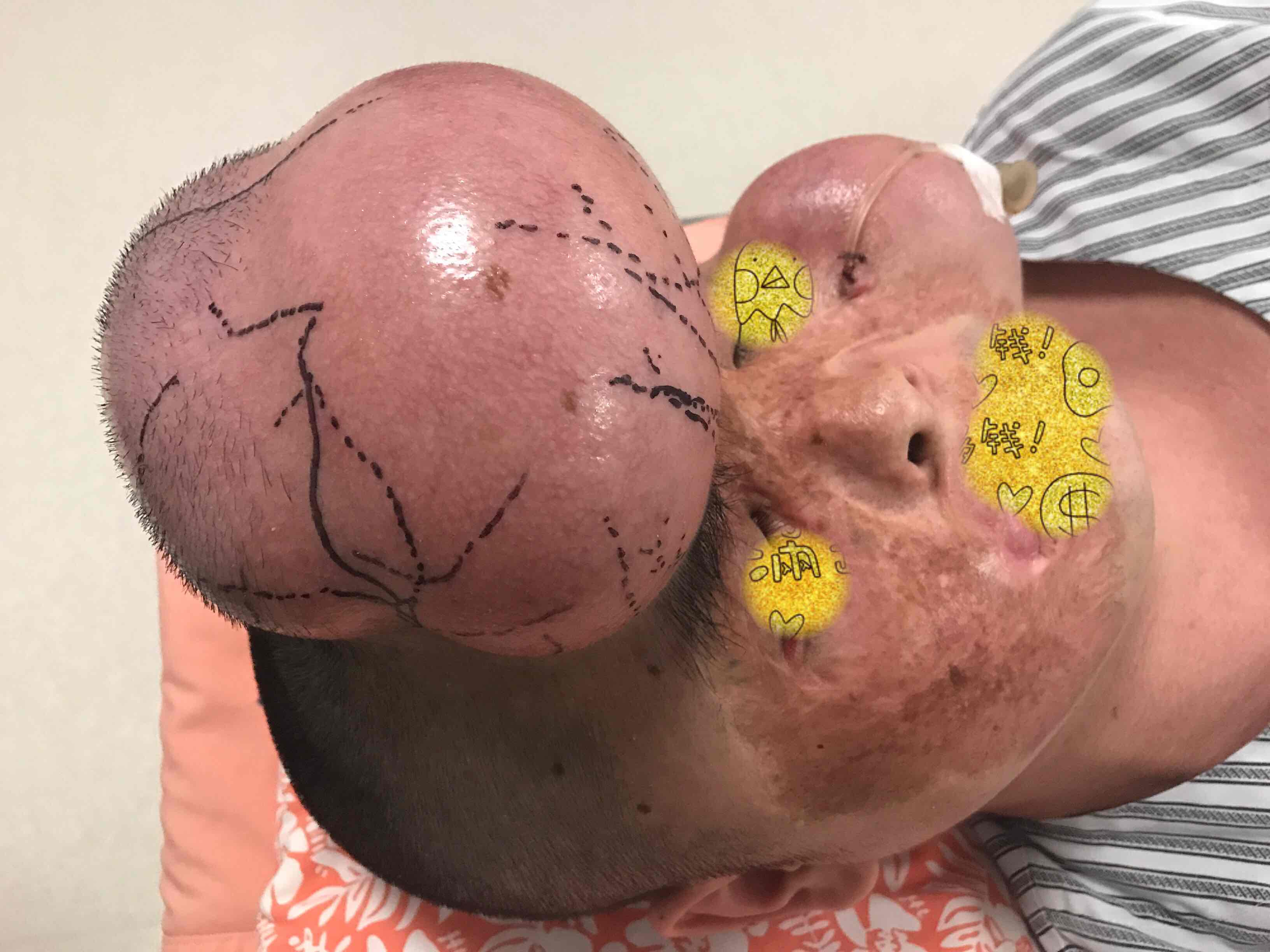 当皮肤可以无限扩张的时候,换个脸算什么?