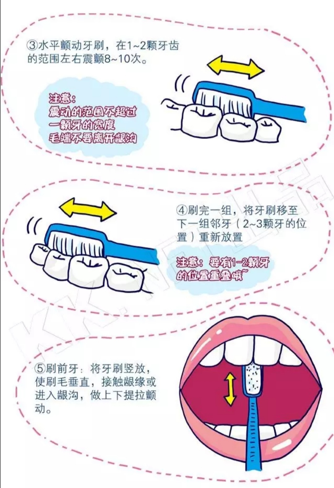 我每天都很认真的刷牙,为什么还是会有牙石?