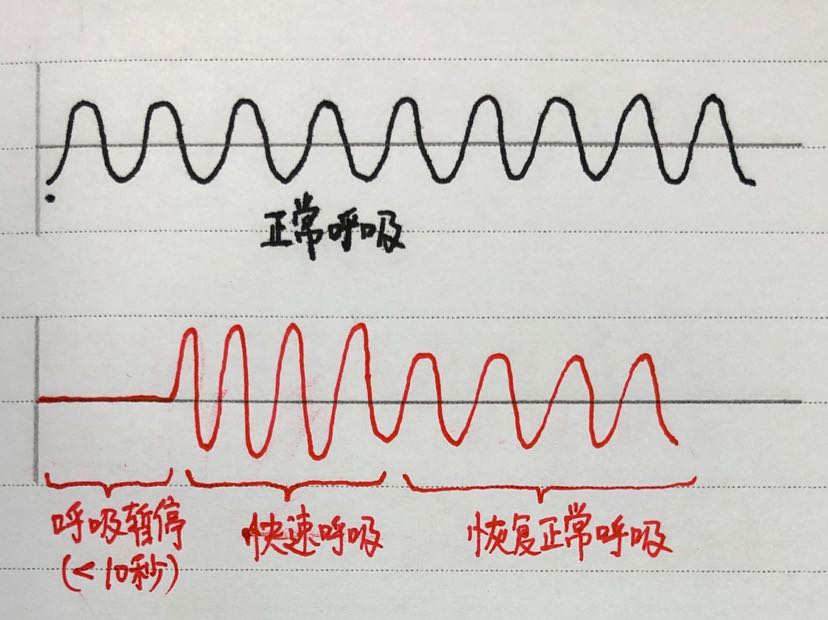 宝宝没有面色青紫或其他不适(下图是周期性呼吸跟正常呼吸的对比)