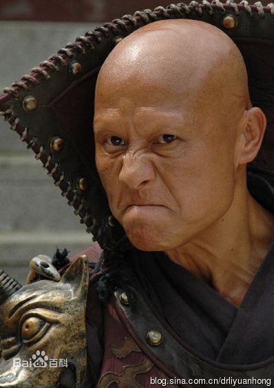 提防"鬼剃头"-斑秃