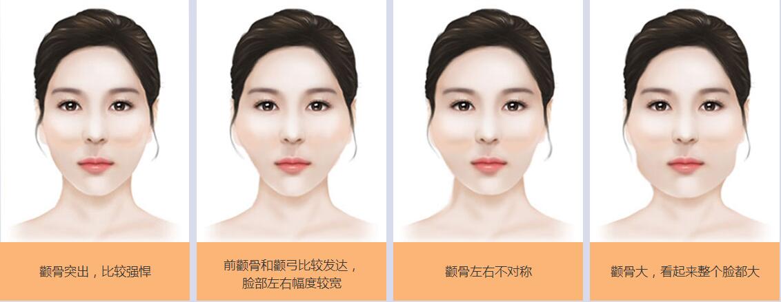 颧骨手术切口在哪里?吃什么对术后的消肿有帮助