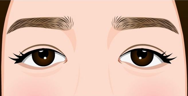 眼睛聚光部分减少,容易无神上睑下垂的眼睛会遮住部分黑眼球存在上睑