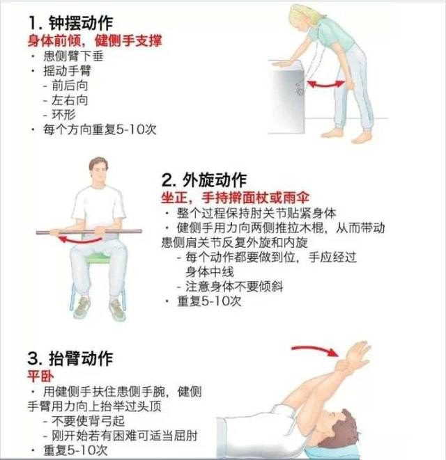 肩袖损伤康复训练方法图片