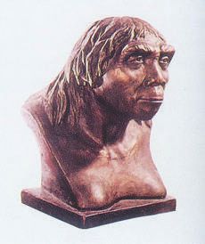 牙齿矫正送你一个美丽微笑