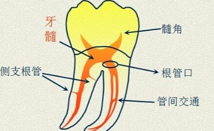 乳牙根管解剖图图片
