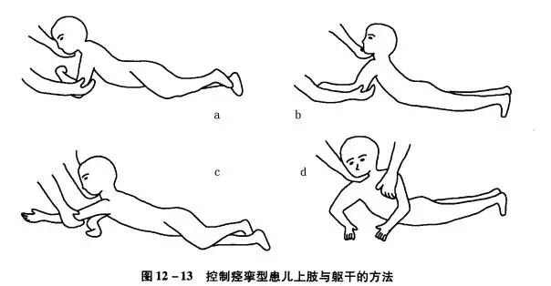 对脑瘫患儿全身的控制训练方法