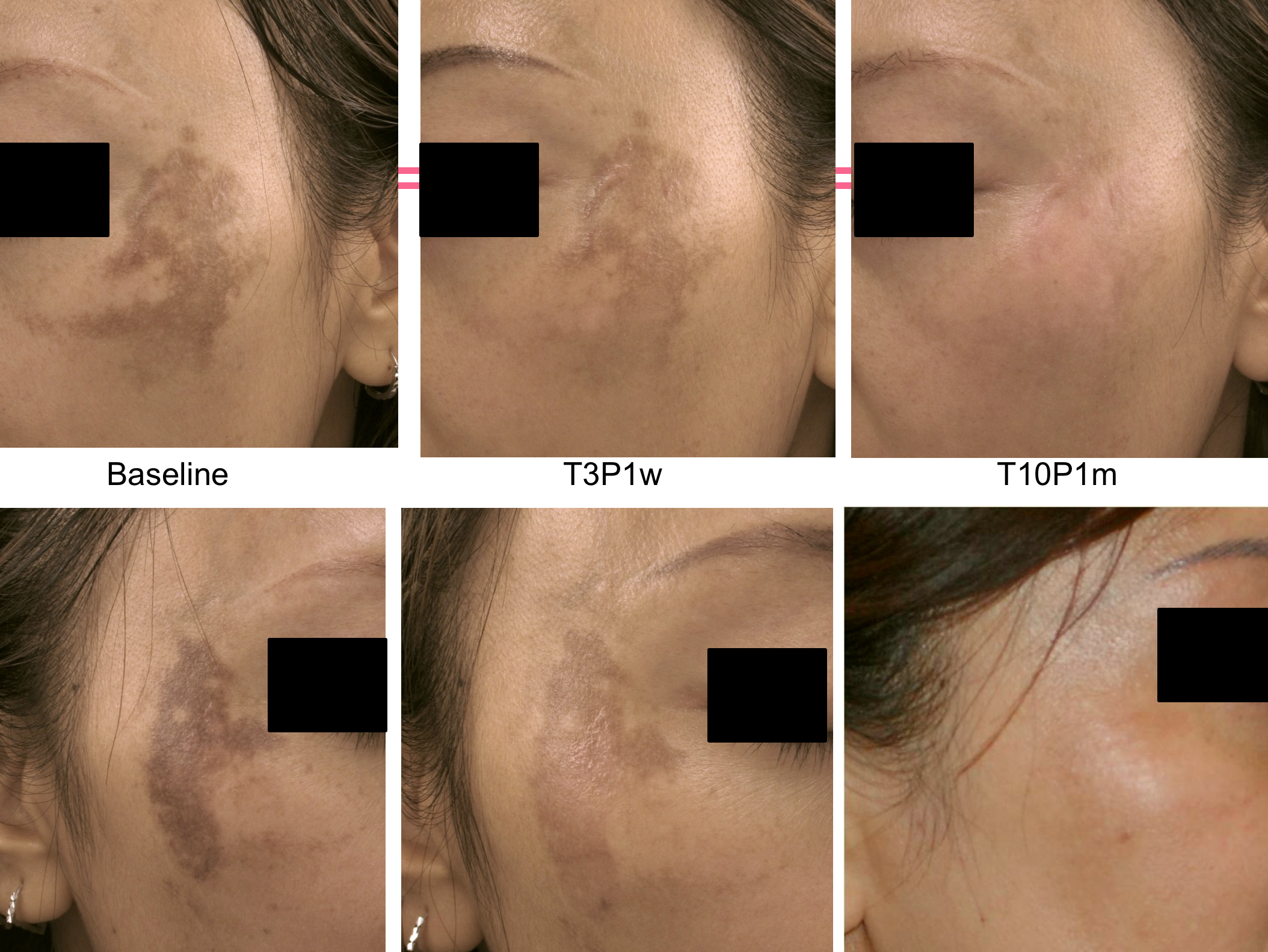 色沉的解决之道