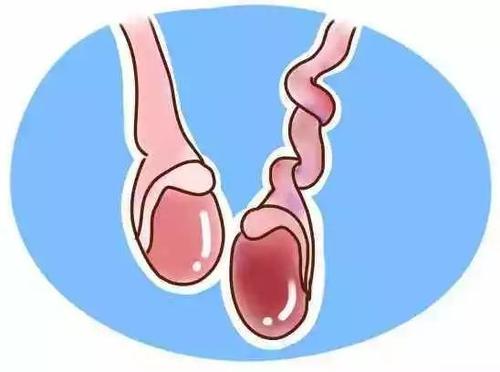 出现睾丸异常时得尽快检查