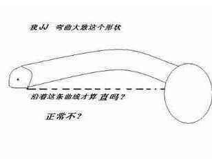 阴茎弯曲都需要治疗吗?