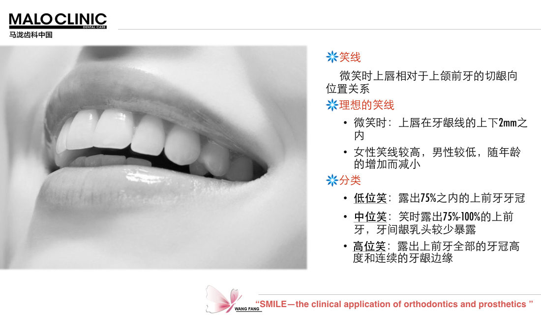 露牙龈的笑容,你觉得美吗?(上)