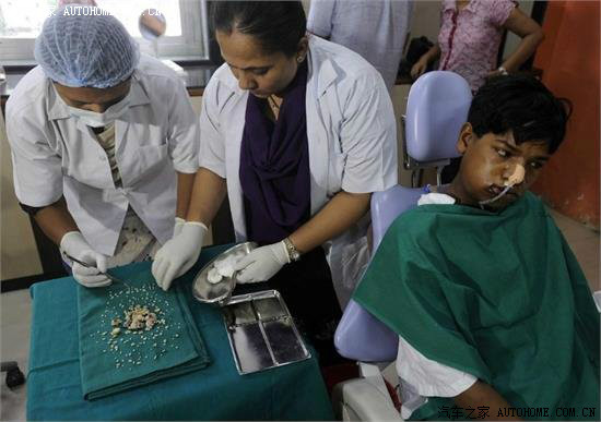 复质牙瘤最高增生纪录是37颗,而且多数病例都长在上牙床,印度少年贾瓦