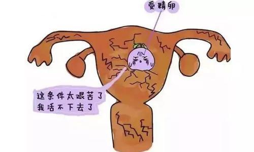 孕妈都怕胎停育医生只说优胜劣汰胎停育常见原因如何预防