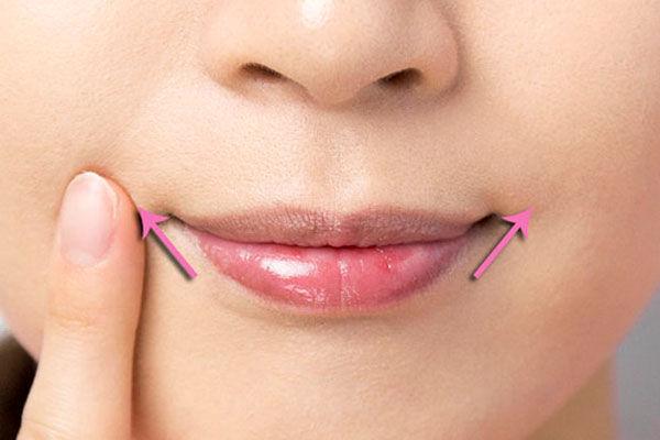 妙用5:改善嘴角下垂肉毒素能祛除鱼尾纹,抬头纹,皱眉纹等上半脸的表情