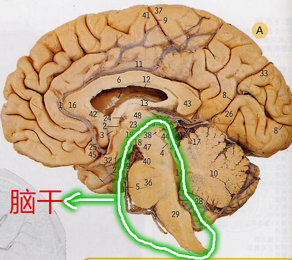 脑干出血你知道多少