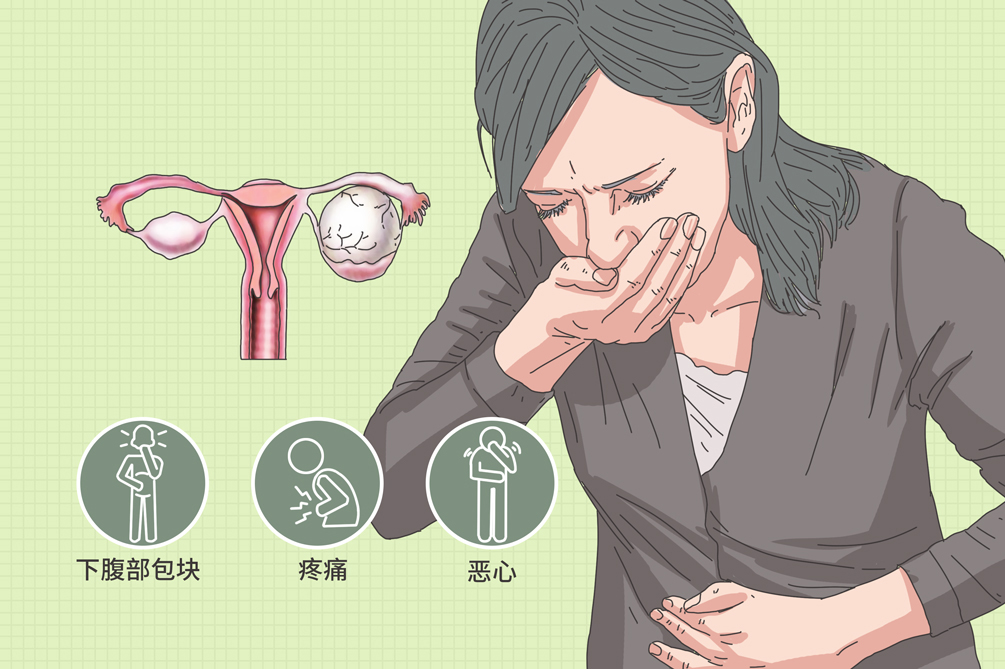 卵巢畸胎瘤在妇产科看还是在妇瘤科更好?应该怎么治疗?