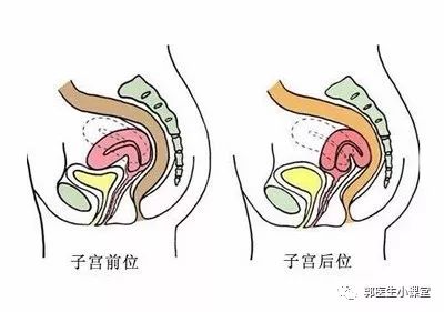 婚后发现不孕,婆婆逼我离婚,后位子宫真的会不孕吗?