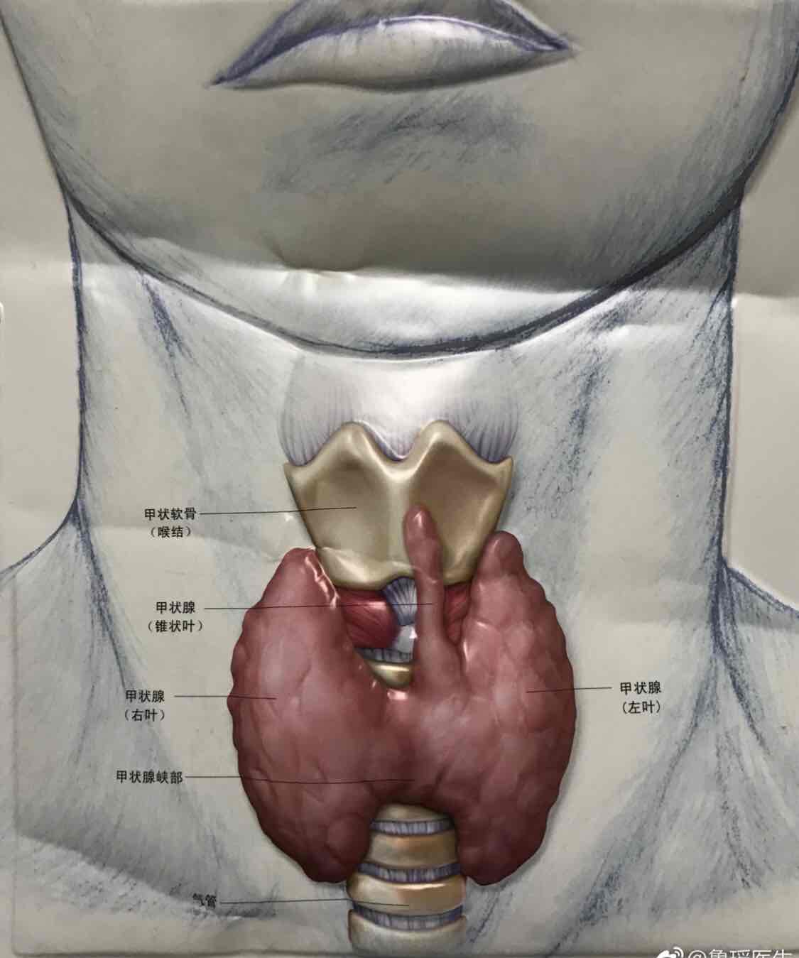 甲状腺结节是肿瘤吗