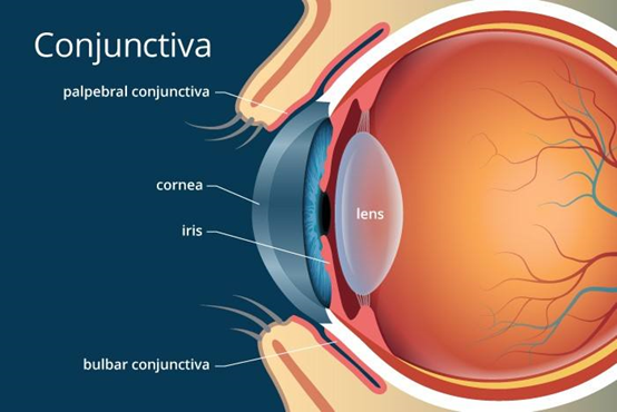 从组织学和解剖学角度来看,首先,结膜是一层松散的弹性粘连保护层覆盖