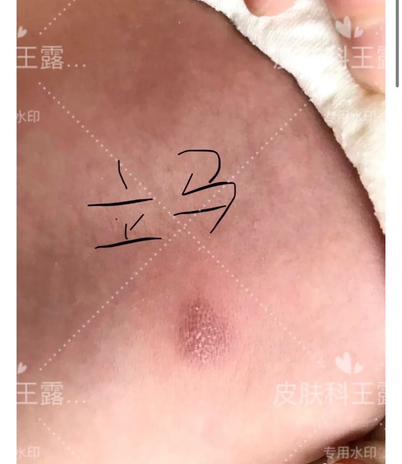 网络咨询的一例肥大细胞瘤