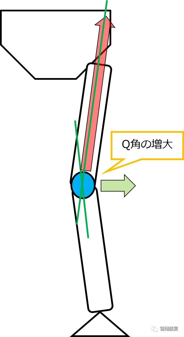 明明伤的是左腿,为什么我的右腿也会疼?