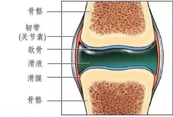 不明原因的膝關節腫脹,疼痛,需警惕滑膜炎在