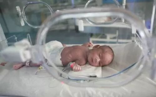 早产儿为什么要放保温箱？保温箱有哪些作用？