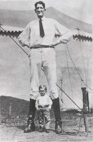 什么是肢端肥大症?如何治疗?