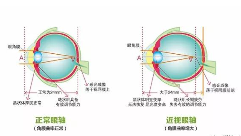 如上图所示,从眼球接收光线的最表层,即从角膜-晶状体-玻璃体-视网膜