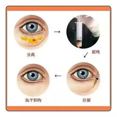 眶隔图片,眶隔,眶隔脂肪_大山谷图库
