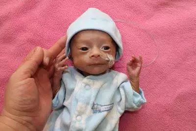 早产儿为什么要放保温箱？保温箱有哪些作用？